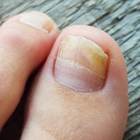 INFORMACJE DERMATOLOGICZNE!