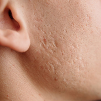 INFORMACJE DERMATOLOGICZNE!