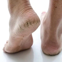 INFORMACJE DERMATOLOGICZNE!