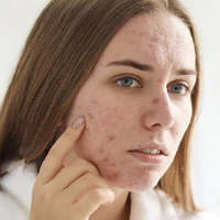 INFORMACJE DERMATOLOGICZNE!
