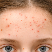 INFORMACJE DERMATOLOGICZNE!
