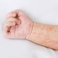 INFORMACJE DERMATOLOGICZNE!
